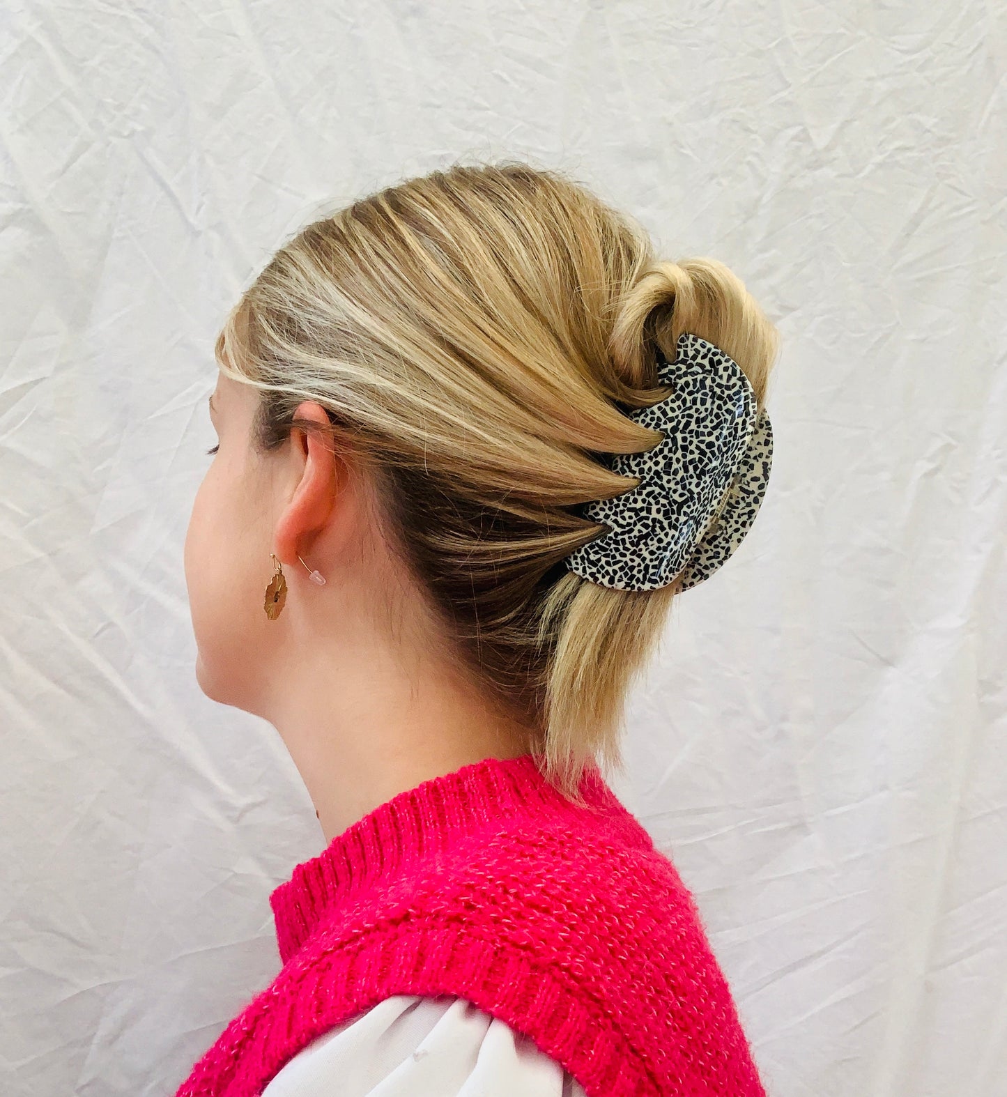 Haarklem ‘dalmation fever'